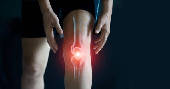 Knee joint osteoarthritis
