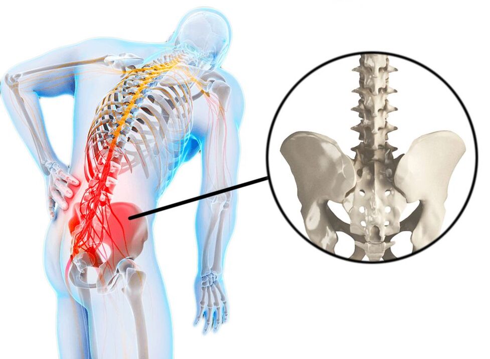lower back pain